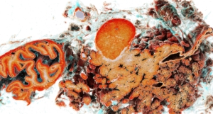 Pancreas