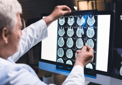 Senior neurologist with MRI scan of human head in clinic