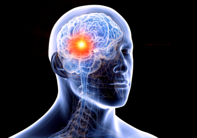 3d rendered medically accurate illustration of the human brain and a tumor