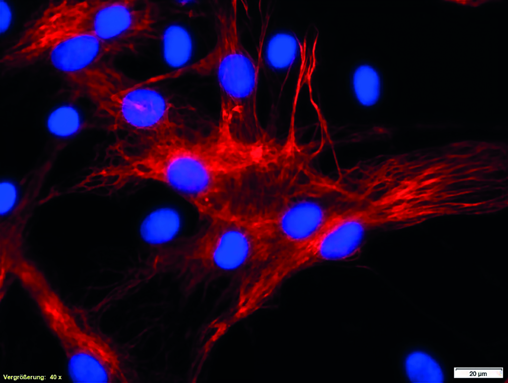 Höhere Auflösung_400_Scharfzeichner_CMYK